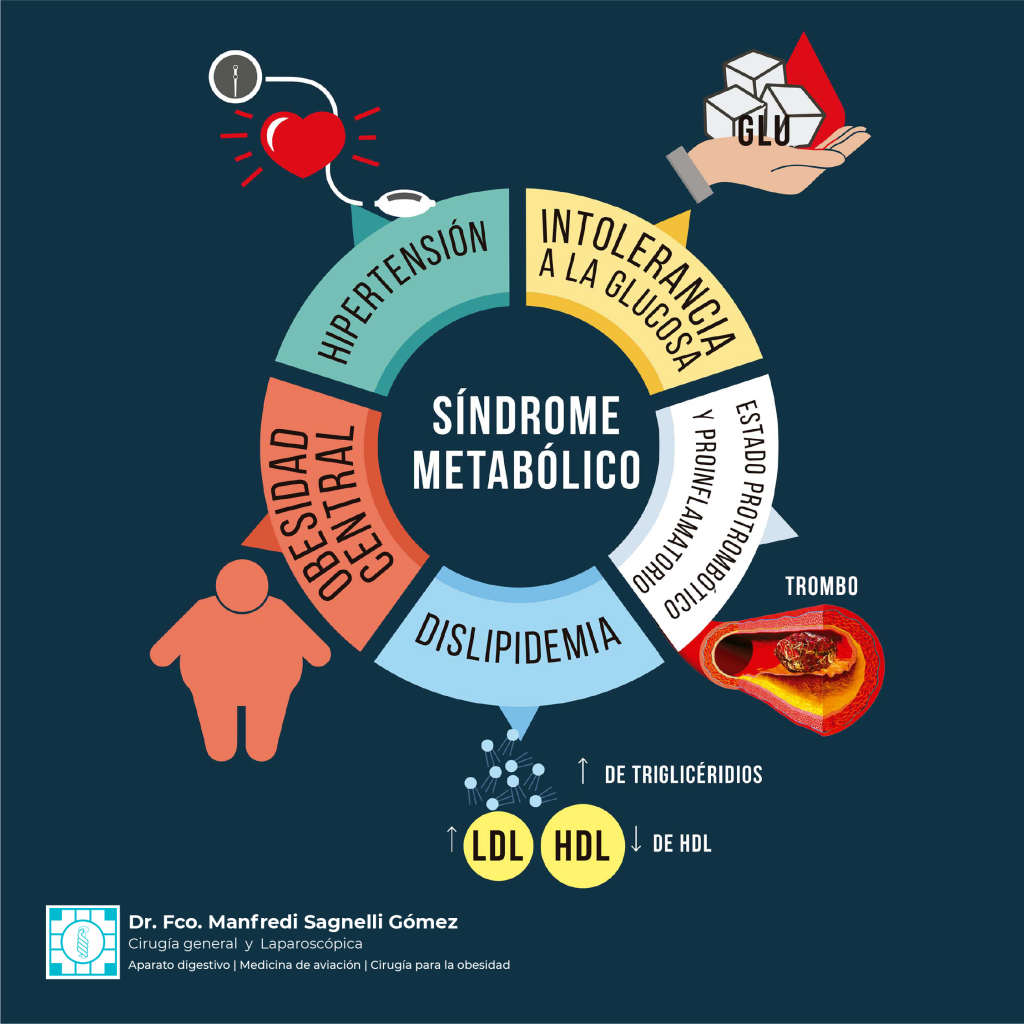 Síndrome Metabólico en Guadalajara