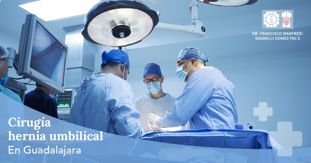 Cirugía hernia umbilical en Guadalajara